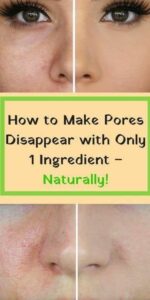 How to Make Pores Disappear with Only 1 Ingredient!