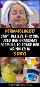 DERMATOLOGISTS CAN’T BELIEVE THIS SHE USED HER GRANDMAS FORMULA TO ERASE HER WRINKLES IN 3 DAYS